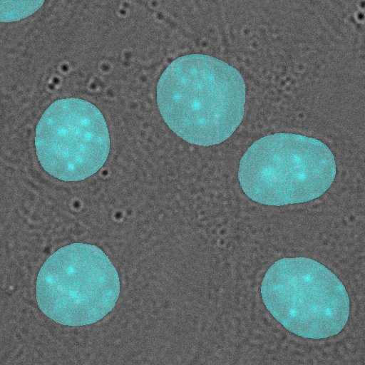Live AR view: cyan virtual nuclei overlaid on the raw DIC microscope feed in real time