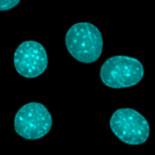 The same field after CytoByte virtual staining — nuclei rendered in high contrast on black